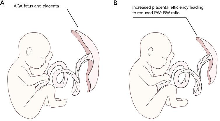https://cdn.ncbi.nlm.nih.gov/pmc/blobs/6c86/8429875/3671ec9167b3/tp-10-08-2148-f2.jpg