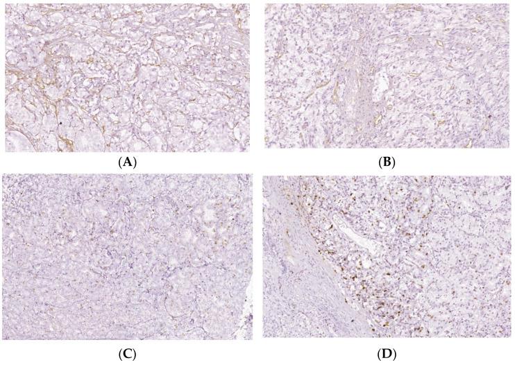 https://cdn.ncbi.nlm.nih.gov/pmc/blobs/6c8b/9313300/2e6d56a7034b/biomedicines-10-01672-g006.jpg