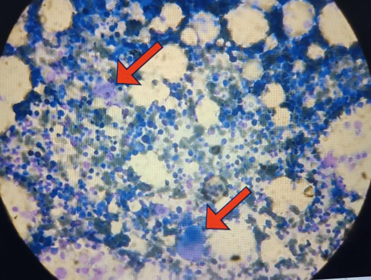 https://cdn.ncbi.nlm.nih.gov/pmc/blobs/6c90/11580732/a08508bcc836/cureus-0016-00000072127-i02.jpg