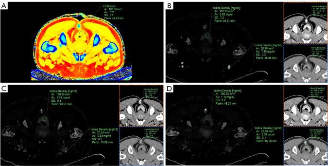 https://cdn.ncbi.nlm.nih.gov/pmc/blobs/6c91/10784072/fba4e7630200/qims-14-01-618-f2.jpg