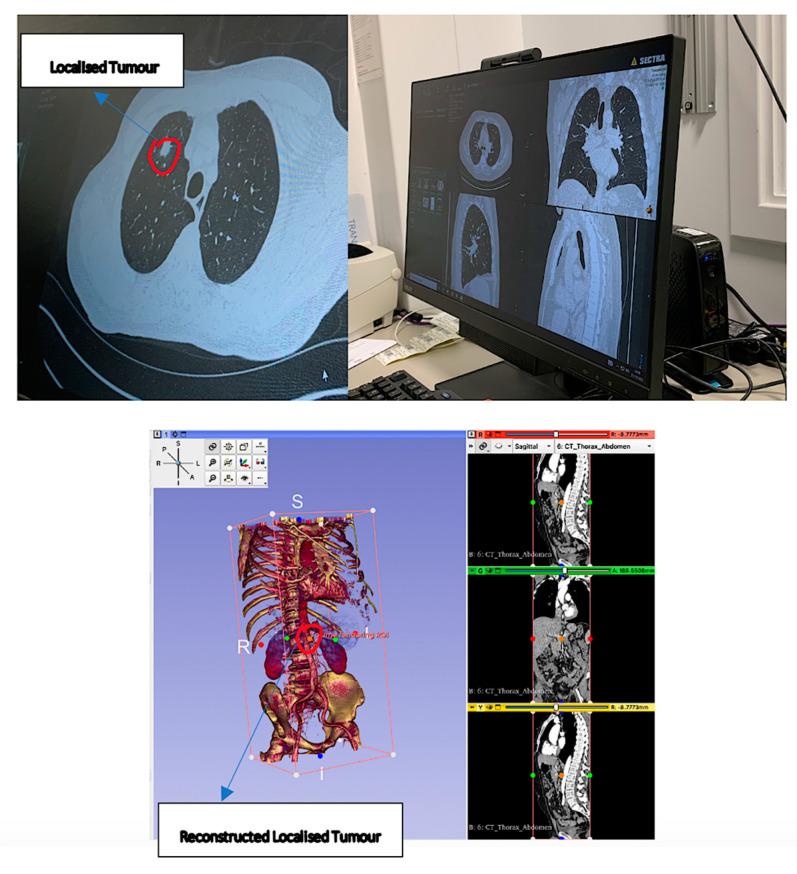 https://cdn.ncbi.nlm.nih.gov/pmc/blobs/6c97/10347167/90c83f7d0e9b/sensors-23-06202-g007.jpg