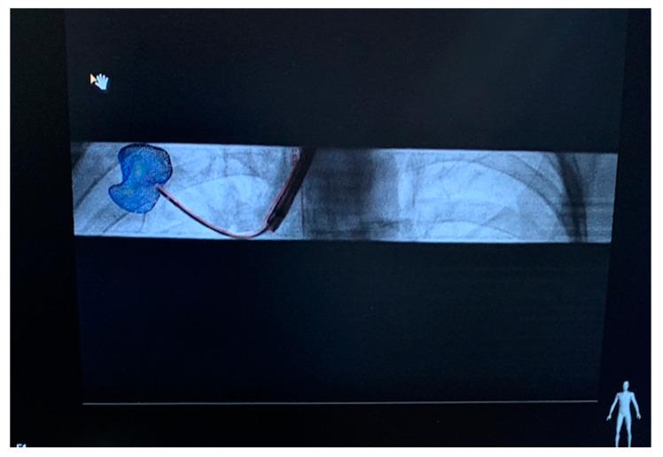 https://cdn.ncbi.nlm.nih.gov/pmc/blobs/6c97/10347167/91a4b98543ec/sensors-23-06202-g005.jpg