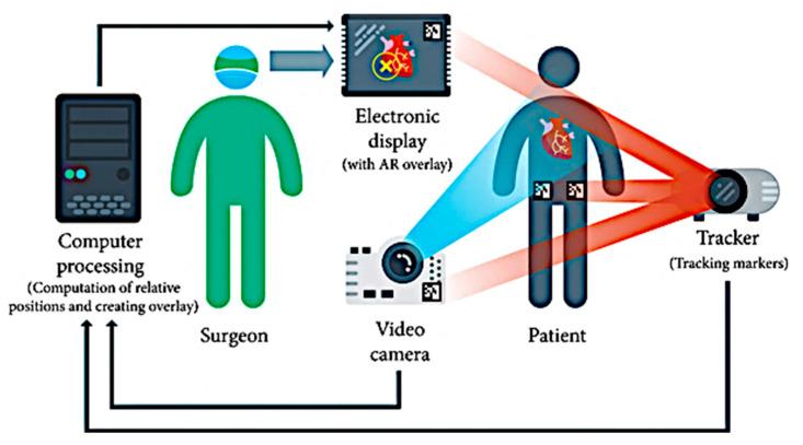 https://cdn.ncbi.nlm.nih.gov/pmc/blobs/6c97/10347167/bb434eeda21a/sensors-23-06202-g004.jpg