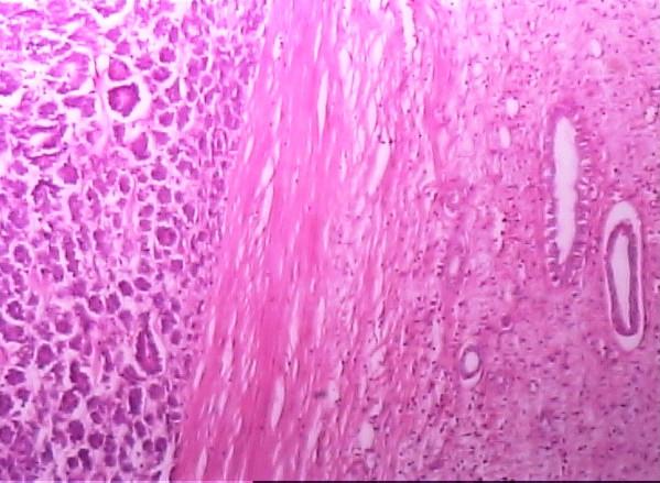 https://cdn.ncbi.nlm.nih.gov/pmc/blobs/6c97/1702367/a2bcbf531dbb/1746-1596-1-46-1.jpg