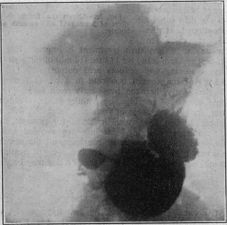 https://cdn.ncbi.nlm.nih.gov/pmc/blobs/6c9d/2055187/c7d953ad7f3a/brmedj03737-0006-a.jpg