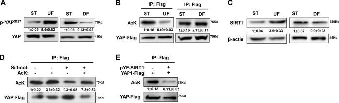 https://cdn.ncbi.nlm.nih.gov/pmc/blobs/6c9d/7035362/55261f2e6a03/41419_2020_2343_Fig5_HTML.jpg