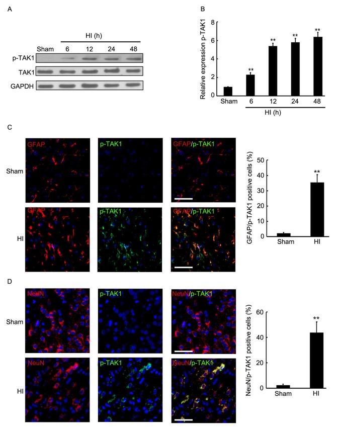 https://cdn.ncbi.nlm.nih.gov/pmc/blobs/6c9f/5780114/85ba51c5d592/MMR-17-01-1710-g00.jpg