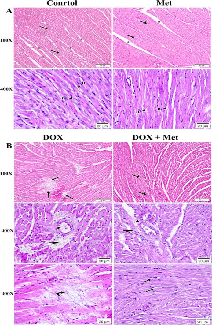 https://cdn.ncbi.nlm.nih.gov/pmc/blobs/6ca4/11985558/ab37d23090a4/12010_2024_5141_Fig2_HTML.jpg