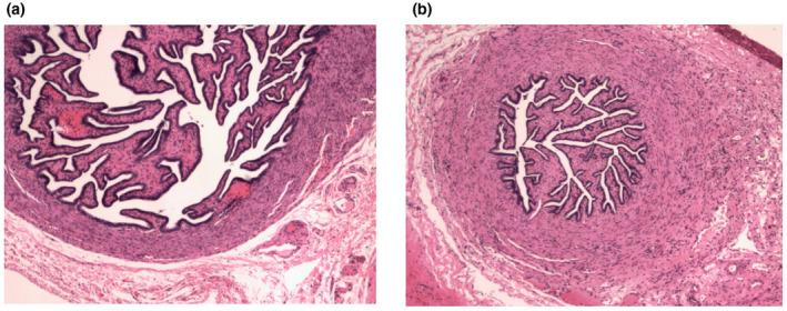 https://cdn.ncbi.nlm.nih.gov/pmc/blobs/6ca6/7507566/b34025a11dff/MGG3-8-e1396-g001.jpg