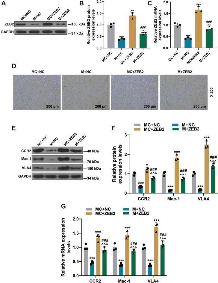 https://cdn.ncbi.nlm.nih.gov/pmc/blobs/6cac/10209027/dd1c4c2f2643/gr4.jpg