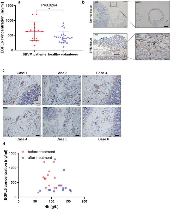 https://cdn.ncbi.nlm.nih.gov/pmc/blobs/6cae/11104802/67bc0b285d50/18_2020_3465_Fig1_HTML.jpg