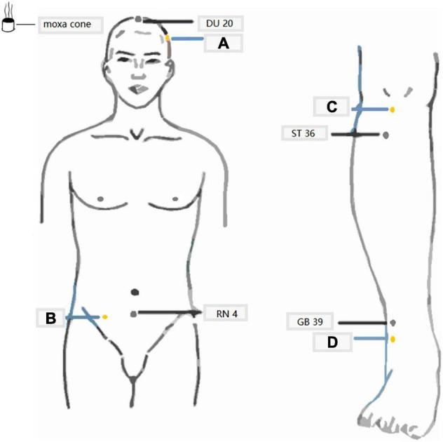 https://cdn.ncbi.nlm.nih.gov/pmc/blobs/6cb7/9204283/bdfae2f9e132/fnagi-14-773687-g001.jpg