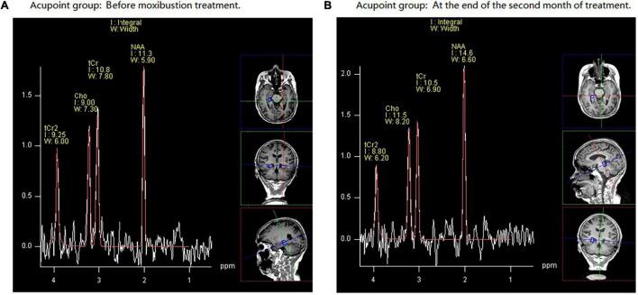 https://cdn.ncbi.nlm.nih.gov/pmc/blobs/6cb7/9204283/debb673e1dc4/fnagi-14-773687-g004.jpg