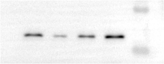 https://cdn.ncbi.nlm.nih.gov/pmc/blobs/6cbc/11538732/07fd138df042/mmcfigs4.jpg