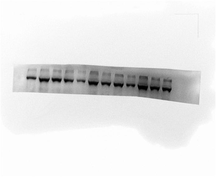 https://cdn.ncbi.nlm.nih.gov/pmc/blobs/6cbc/11538732/8b0fc7986d33/mmcfigs1.jpg