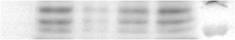 https://cdn.ncbi.nlm.nih.gov/pmc/blobs/6cbc/11538732/8babcd371f75/mmcfigs6.jpg
