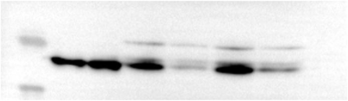 https://cdn.ncbi.nlm.nih.gov/pmc/blobs/6cbc/11538732/f81e32cf9486/mmcfigs5.jpg