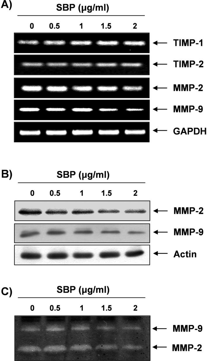 https://cdn.ncbi.nlm.nih.gov/pmc/blobs/6cc8/3584623/253047eab34d/IJO-40-04-1210-g06.jpg