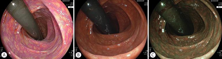 https://cdn.ncbi.nlm.nih.gov/pmc/blobs/6cc8/8357597/93aa1e76fcae/ce-2021-157f2.jpg