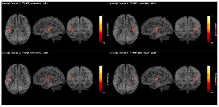 https://cdn.ncbi.nlm.nih.gov/pmc/blobs/6cc9/8946618/cf9d488d8d7c/brainsci-12-00334-g004.jpg