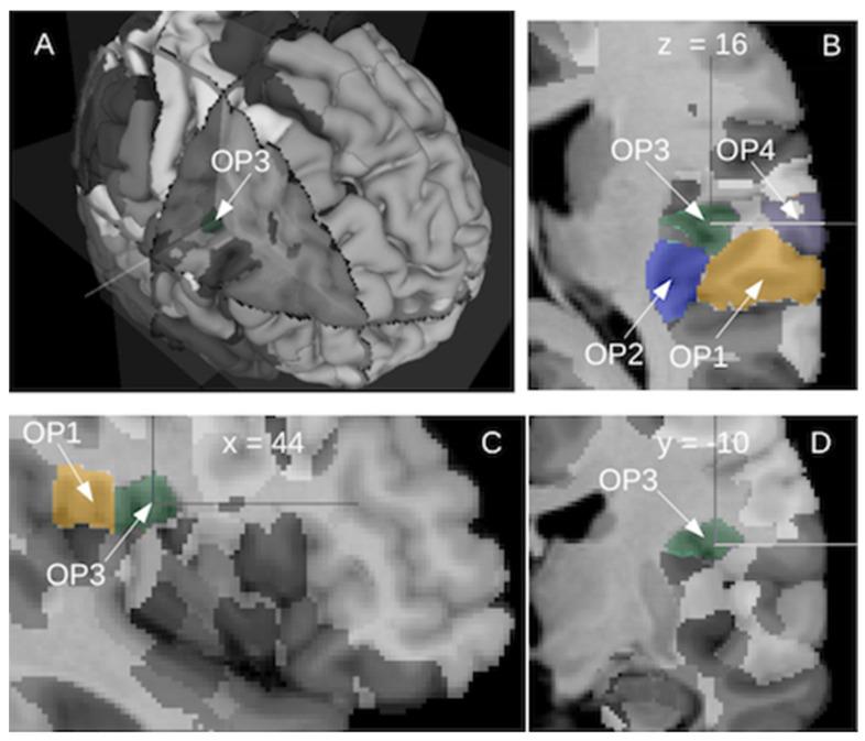 https://cdn.ncbi.nlm.nih.gov/pmc/blobs/6cc9/8946618/e67917dc3858/brainsci-12-00334-g002.jpg