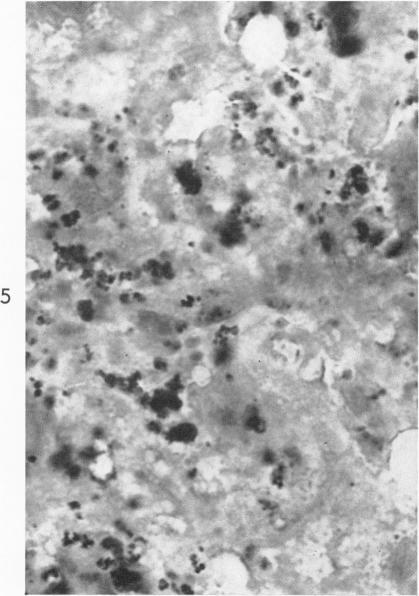https://cdn.ncbi.nlm.nih.gov/pmc/blobs/6cd4/1920395/85923f8041b8/amjpathol00295-0083-e.jpg