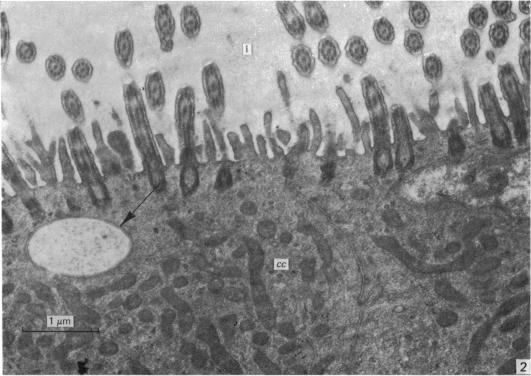 https://cdn.ncbi.nlm.nih.gov/pmc/blobs/6cd9/1232932/332ceea53da9/janat00242-0039-a.jpg