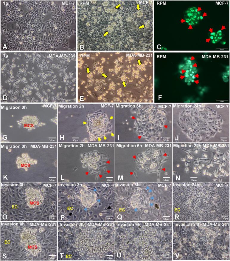 https://cdn.ncbi.nlm.nih.gov/pmc/blobs/6cda/8278480/7deb81c81a7c/fcell-09-672098-g001.jpg