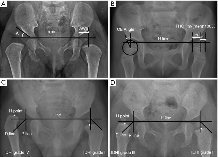 https://cdn.ncbi.nlm.nih.gov/pmc/blobs/6cdd/10248943/e0450e096dc9/tp-12-05-861-f1.jpg