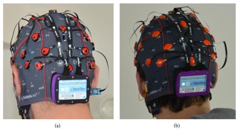 https://cdn.ncbi.nlm.nih.gov/pmc/blobs/6ce1/4475755/5e7106684b93/TSWJ2015-623896.005.jpg