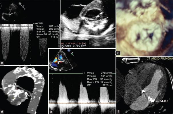 https://cdn.ncbi.nlm.nih.gov/pmc/blobs/6ce1/9997457/300c79e01ed6/ACA-26-78-g001.jpg