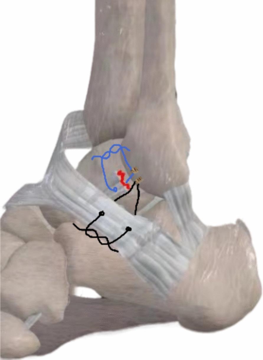 https://cdn.ncbi.nlm.nih.gov/pmc/blobs/6ce3/11289923/57af3036d256/13018_2024_4916_Fig7_HTML.jpg