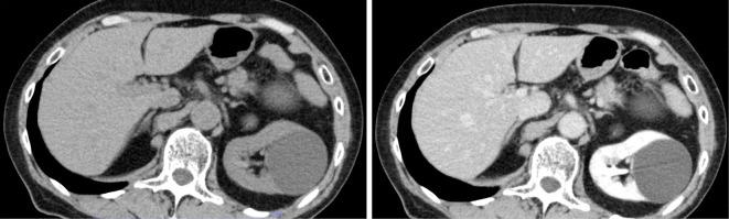 https://cdn.ncbi.nlm.nih.gov/pmc/blobs/6cf1/12223388/1eb2a381a123/1349-7235-64-11-1777-g003.jpg