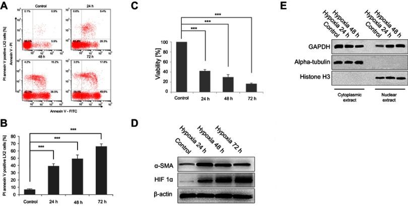https://cdn.ncbi.nlm.nih.gov/pmc/blobs/6cf5/6553950/21a354769802/CMAR-11-4947-g0001.jpg
