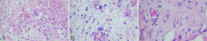 https://cdn.ncbi.nlm.nih.gov/pmc/blobs/6cf9/12059831/24080eb4765e/NarraJ-5-e1873-g005.jpg