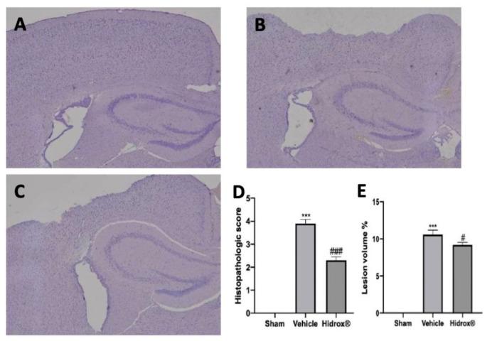 https://cdn.ncbi.nlm.nih.gov/pmc/blobs/6cff/8161307/effd1bf4dbb2/antioxidants-10-00818-g001.jpg