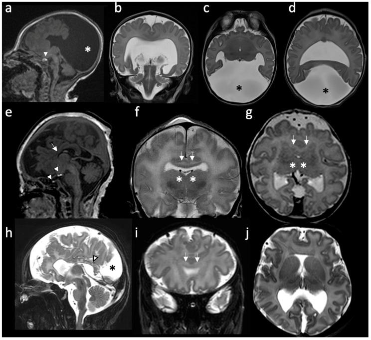 https://cdn.ncbi.nlm.nih.gov/pmc/blobs/6d01/10137117/4dcb17539031/children-10-00647-g001.jpg