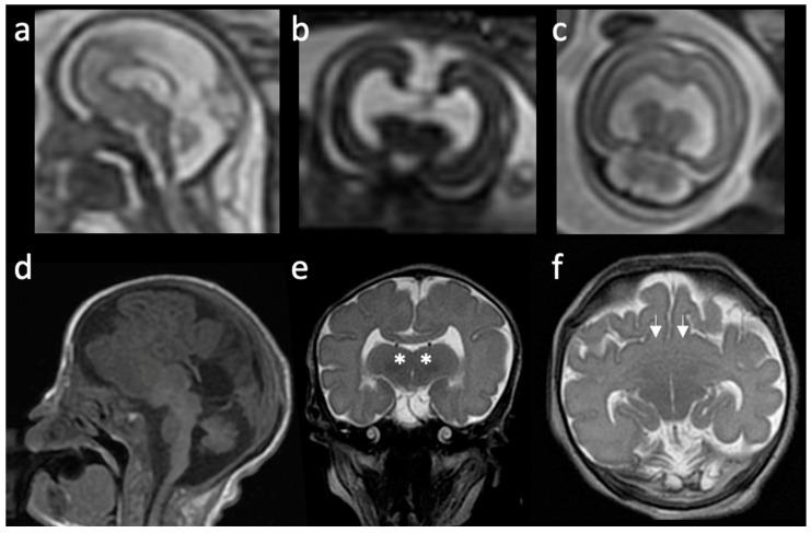https://cdn.ncbi.nlm.nih.gov/pmc/blobs/6d01/10137117/83addc673cc1/children-10-00647-g002.jpg