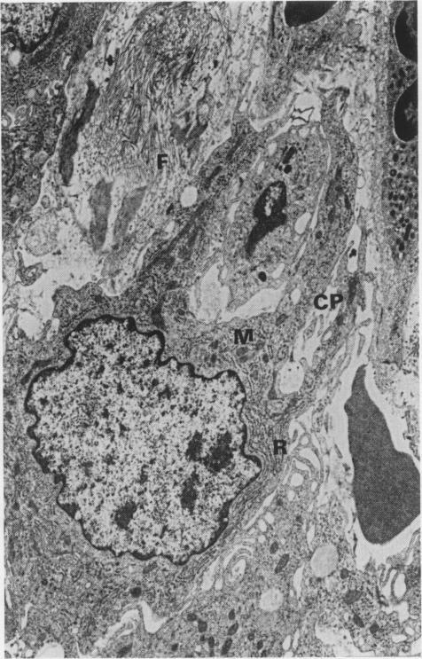 https://cdn.ncbi.nlm.nih.gov/pmc/blobs/6d03/2013191/8d8cdcb8319f/brjexppathol00001-0071-a.jpg