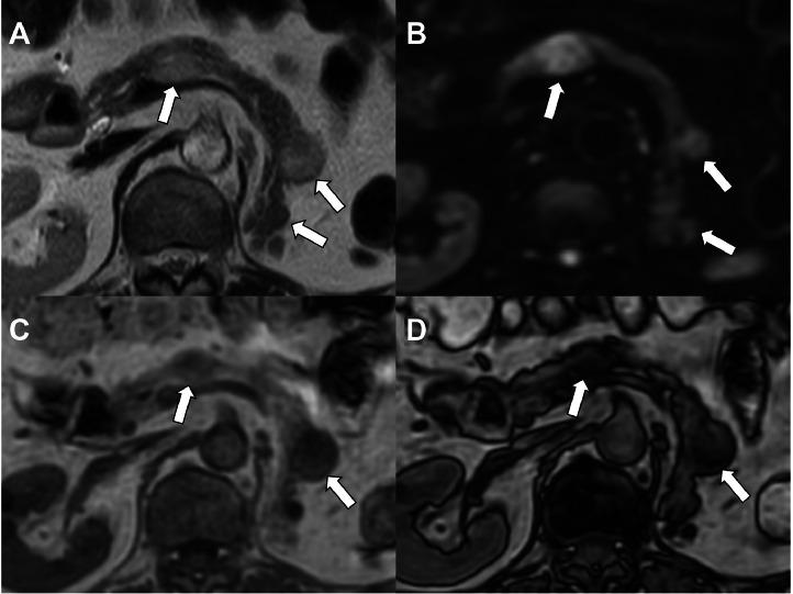 https://cdn.ncbi.nlm.nih.gov/pmc/blobs/6d04/11930679/ceda7d63ae1d/gr2.jpg