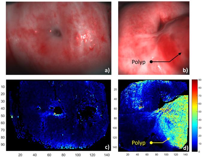 https://cdn.ncbi.nlm.nih.gov/pmc/blobs/6d0d/5453972/2b4c7e192fc3/41598_2017_2645_Fig8_HTML.jpg