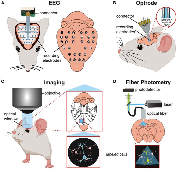 https://cdn.ncbi.nlm.nih.gov/pmc/blobs/6d10/9853197/0b6e2496a881/fneur-13-1040648-g0004.jpg