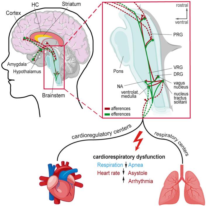 https://cdn.ncbi.nlm.nih.gov/pmc/blobs/6d10/9853197/d4a84b8aa0cf/fneur-13-1040648-g0001.jpg