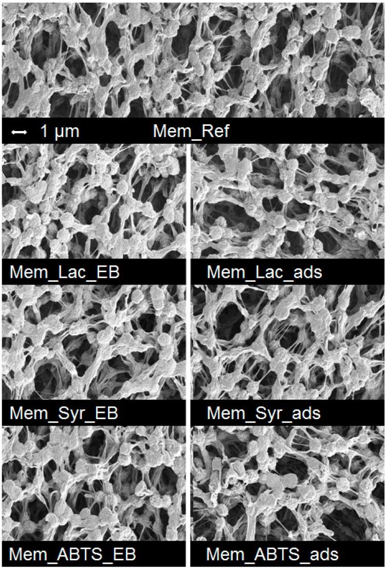 https://cdn.ncbi.nlm.nih.gov/pmc/blobs/6d14/6270853/cec2b7c68dfa/molecules-19-11860-g003.jpg