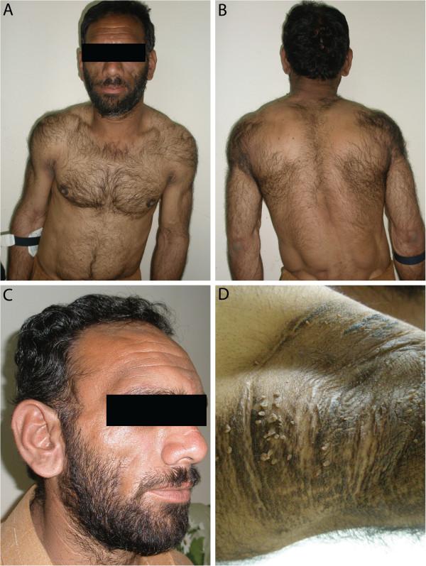 https://cdn.ncbi.nlm.nih.gov/pmc/blobs/6d16/4076434/23428d78a9bc/1471-2350-15-71-2.jpg