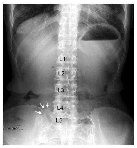 https://cdn.ncbi.nlm.nih.gov/pmc/blobs/6d17/3259137/872643a1f28a/kjpain-25-43-g001.jpg