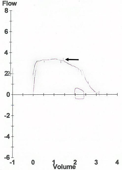 https://cdn.ncbi.nlm.nih.gov/pmc/blobs/6d24/7906545/51f760616243/PAMJ-34-137-g005.jpg