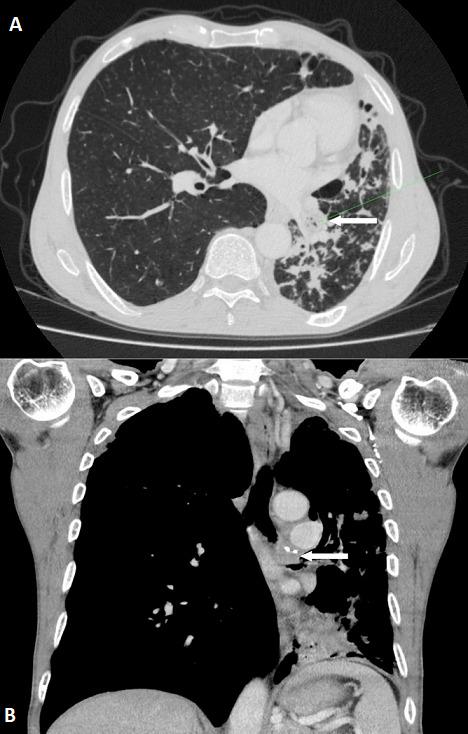 https://cdn.ncbi.nlm.nih.gov/pmc/blobs/6d24/7906545/6a92a079893e/PAMJ-34-137-g002.jpg