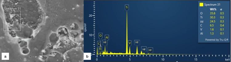 https://cdn.ncbi.nlm.nih.gov/pmc/blobs/6d25/11062495/f8539ffeb74f/cureus-0016-00000057385-i05.jpg