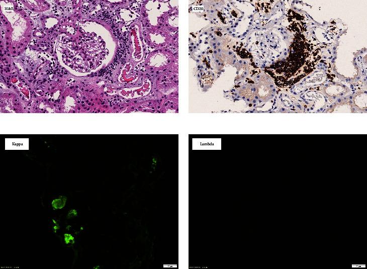 https://cdn.ncbi.nlm.nih.gov/pmc/blobs/6d28/10923615/118605be760a/CRIN2024-5524746.001.jpg
